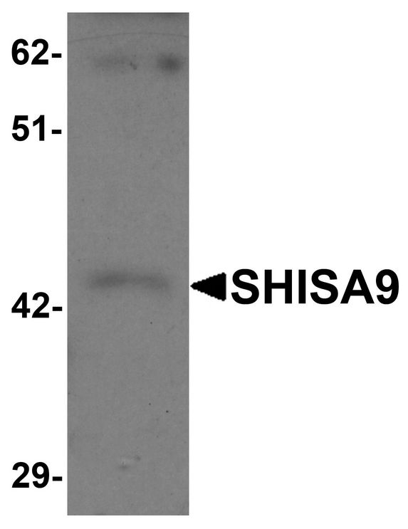 SHISA9 Antibody - Western blot analysis of SHISA9 in rat brain tissue lysate with SHISA9 antibody at 1 ug/ml.