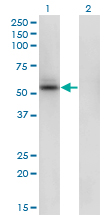 SHMT / SHMT1 Antibody - Western blot of SHMT1 expression in transfected 293T cell line by SHMT1 monoclonal antibody clone 4F9.