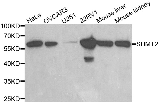 SHMT / SHMT2 Antibody - Western blot analysis of extracts of various cell lines, using SHMT2 antibody.