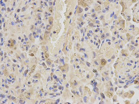 SHMT / SHMT2 Antibody - Immunohistochemistry of paraffin-embedded human lung using SHMT2 antibody at dilution of 1:200 (400x lens).