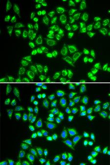 SHMT / SHMT2 Antibody - Immunofluorescence analysis of HeLa cells.