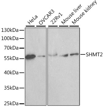 SHMT / SHMT2 Antibody - Western blot analysis of extracts of various cell lines, using SHMT2 antibody at 1:1000 dilution. The secondary antibody used was an HRP Goat Anti-Rabbit IgG (H+L) at 1:10000 dilution. Lysates were loaded 25ug per lane and 3% nonfat dry milk in TBST was used for blocking. An ECL Kit was used for detection.