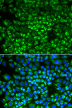 SHMT / SHMT2 Antibody - Immunofluorescence analysis of HeLa cells using SHMT2 antibody. Blue: DAPI for nuclear staining.
