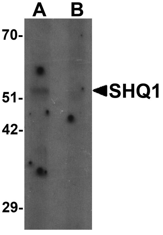 SHQ1 Antibody - Western blot analysis of SHQ1 in human heart tissue lysate with SHQ1 antibody at 1 ug/ml in (A) the absence and (B) the presence of blocking peptide.