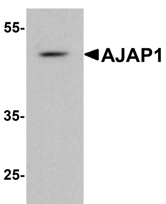 SHREW-1 / AJAP1 Antibody - Western blot analysis of AJAP1 in rat liver tissue lysate with AJAP1 antibody at 1 µg/ml.