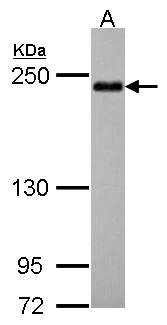 SHROOM2 Antibody - Sample (30 ug of whole cell lysate). A: Hep G2. 5% SDS PAGE. SHROOM2 antibody diluted at 1:500. 
