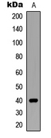 SIAH2 Antibody - Western blot analysis of SIAH2 expression in MCF7 (A) whole cell lysates.
