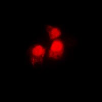 SIAH2 Antibody - Immunofluorescent analysis of SIAH2 staining in MCF7 cells. Formalin-fixed cells were permeabilized with 0.1% Triton X-100 in TBS for 5-10 minutes and blocked with 3% BSA-PBS for 30 minutes at room temperature. Cells were probed with the primary antibody in 3% BSA-PBS and incubated overnight at 4 deg C in a humidified chamber. Cells were washed with PBST and incubated with a DyLight 594-conjugated secondary antibody (red) in PBS at room temperature in the dark. DAPI was used to stain the cell nuclei (blue).