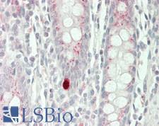 SIAH2 Antibody - Human Colon: Formalin-Fixed, Paraffin-Embedded (FFPE)