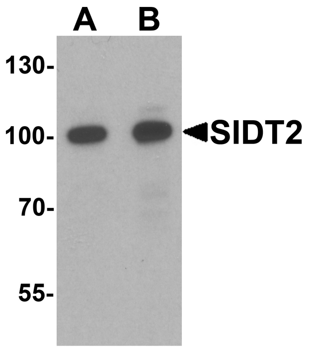 SIDT2 Antibody - Western blot analysis of SIDT2 in mouse brain tissue lysate with SIDT2 antibody at (A) 0.5 and (B) 1 ug/ml.