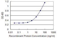 SIK1 / MSK Antibody - Detection limit for recombinant GST tagged SIK1 is 0.3 ng/ml as a capture antibody.