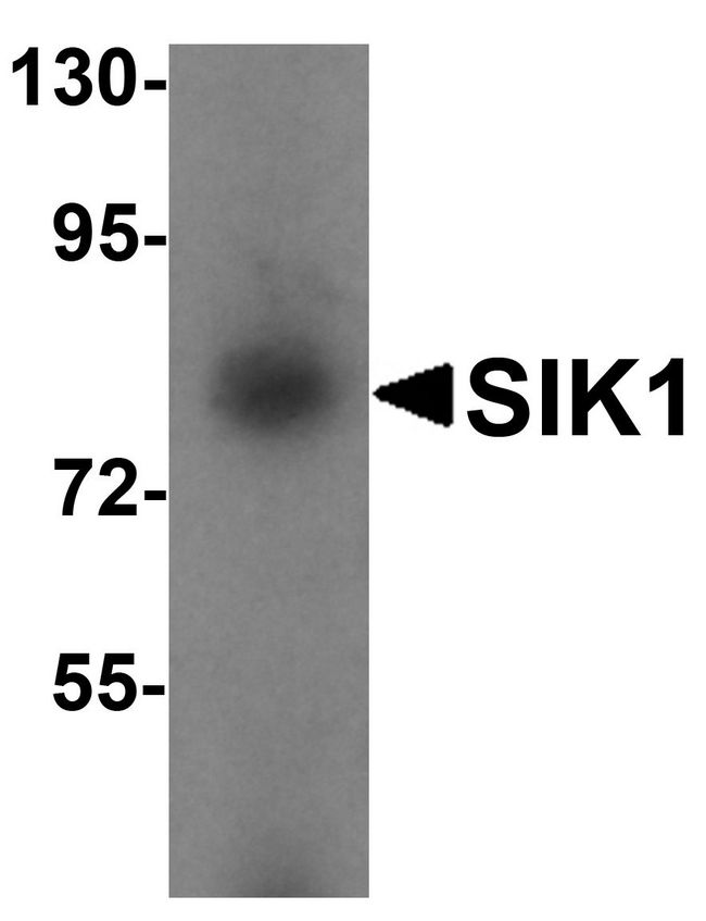SIK1 / MSK Antibody - Western blot analysis of SIK1 in human small intestine tissue lysate with SIK1 antibody at 1 ug/ml.