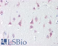 SIK1 / MSK Antibody - Anti-SIK1 / SNF1LK antibody IHC of human brain, cortex. Immunohistochemistry of formalin-fixed, paraffin-embedded tissue after heat-induced antigen retrieval. Antibody concentration 5 ug/ml.