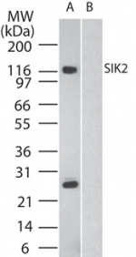 SIK2 / SNF1LK2 Antibody - Western blot of SIK2 in human brain in the A) absence and B) presence of immunizing peptide, using antibody at 2 ug/ml.