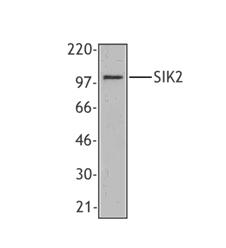 SIK2 / SNF1LK2 Antibody - Western blot of extracts from HeLa cells, using anti-SIK2, clone S15G10.