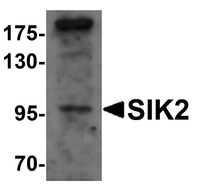 SIK2 / SNF1LK2 Antibody - Western blot analysis of SIK2 in SW480 cell lysate with SIK2 antibody at 1 ug/ml.