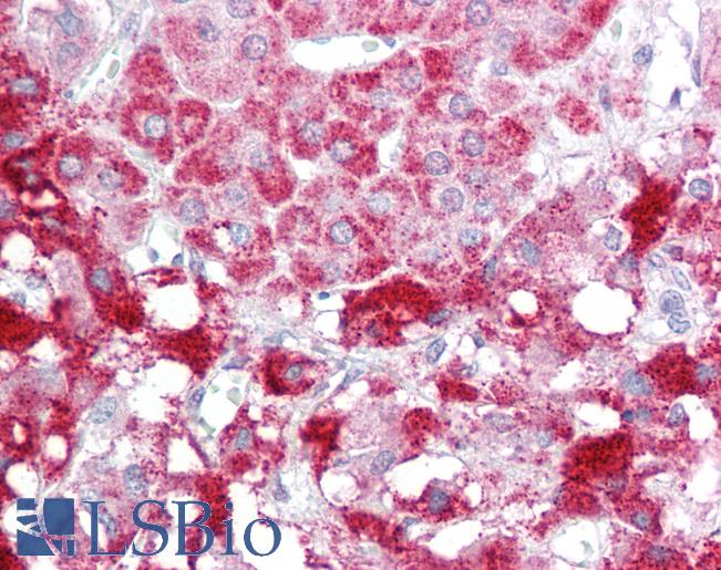 SIK2 / SNF1LK2 Antibody - Anti-SIK2 / SNF1LK2 antibody IHC of human adrenal. Immunohistochemistry of formalin-fixed, paraffin-embedded tissue after heat-induced antigen retrieval. Antibody concentration 5 ug/ml.