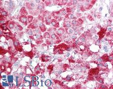 SIK2 / SNF1LK2 Antibody - Anti-SIK2 / SNF1LK2 antibody IHC of human adrenal. Immunohistochemistry of formalin-fixed, paraffin-embedded tissue after heat-induced antigen retrieval. Antibody concentration 5 ug/ml.