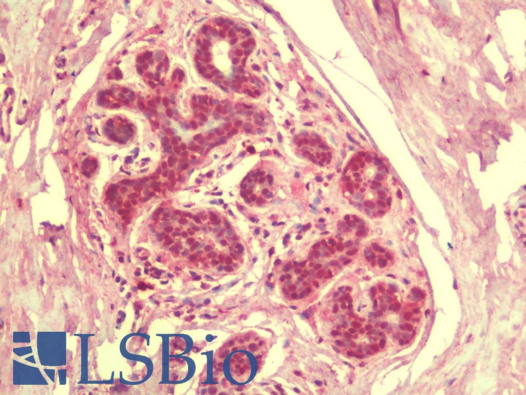 SIK3 / QSK Antibody - Anti-SIK3 / QSK antibody IHC staining of human breast. Immunohistochemistry of formalin-fixed, paraffin-embedded tissue after heat-induced antigen retrieval. Antibody concentration 5 ug/ml.
