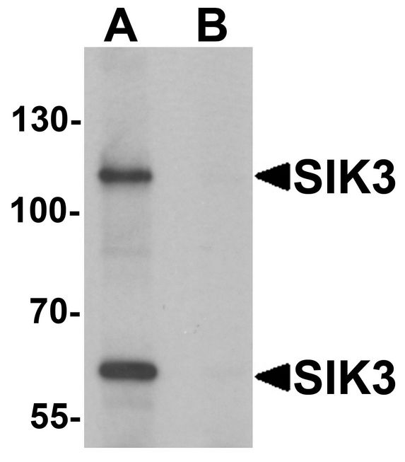 SIK3 / QSK Antibody - Western blot analysis of SIK3 in rat brain tissue lysate with SIK3 antibody at 1 ug/ml in (A) the absence and (B) the presence of blocking peptide.