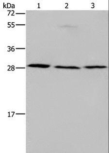 SIP / TP53INP1 Antibody - Western blot analysis of Human fetal liver tissue, 293T and 231 cell, using TP53INP1 Polyclonal Antibody at dilution of 1:200.