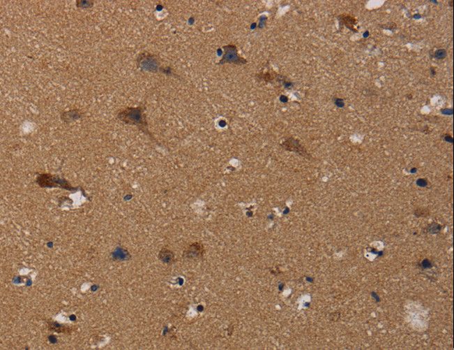 SIP / TP53INP1 Antibody - Immunohistochemistry of paraffin-embedded Human brain using TP53INP1 Polyclonal Antibody at dilution of 1:50.