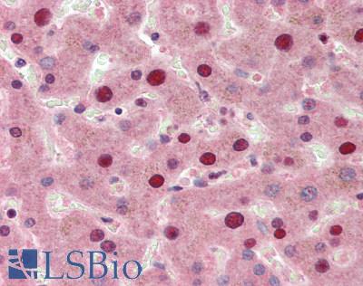 SIP / TP53INP1 Antibody - Human Liver: Formalin-Fixed, Paraffin-Embedded (FFPE), at a concentration of 10 ug/ml.