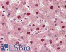 SIP / TP53INP1 Antibody - Human Liver: Formalin-Fixed, Paraffin-Embedded (FFPE), at a concentration of 10 ug/ml.
