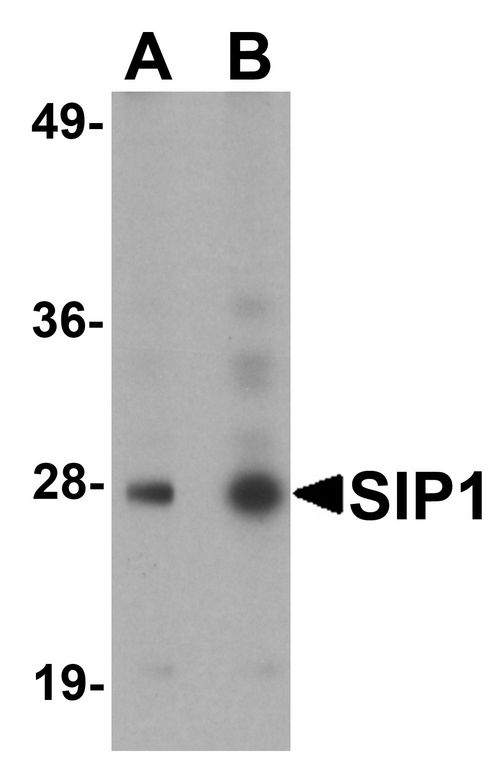 SIP1 Antibody - Western blot analysis of SIP1 in HeLa cell lysate with SIP1 antibody at (A) 0.5 and (B) 1ug/ml.