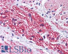 SIP1 Antibody - Anti-SIP1 antibody IHC of human colon, nerve. Immunohistochemistry of formalin-fixed, paraffin-embedded tissue after heat-induced antigen retrieval. Antibody concentration 5 ug/ml.