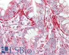 SIPA1 Antibody - Anti-SIPA1 antibody IHC staining of human small intestine. Immunohistochemistry of formalin-fixed, paraffin-embedded tissue after heat-induced antigen retrieval. Antibody concentration 5 ug/ml.