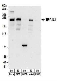 SIPA1L3 Antibody - Detection of Human SIPA1L3 by Western Blot. Samples: Whole cell lysate (50 ug) from HeLa, 293T, MCF7, Jurkat, and K562 cells. Antibodies: Affinity purified rabbit anti-SIPA1L3 antibody used for WB at 0.4 ug/ml. Detection: Chemiluminescence with an exposure time of 30 seconds.