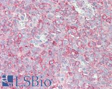 SIPA1L3 Antibody - Human Tonsil: Formalin-Fixed, Paraffin-Embedded (FFPE), at a concentration of 5 ug/ml. 