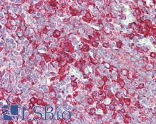 SIPA1L3 Antibody - Human Tonsil: Formalin-Fixed, Paraffin-Embedded (FFPE), at a concentration of 5 ug/ml.