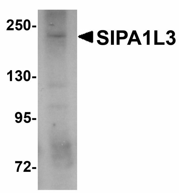 SIPA1L3 Antibody - Western blot of SIPA1L3 in SK-N-SH lysate with SIPA1L3 antibody at 1 ug/ml.
