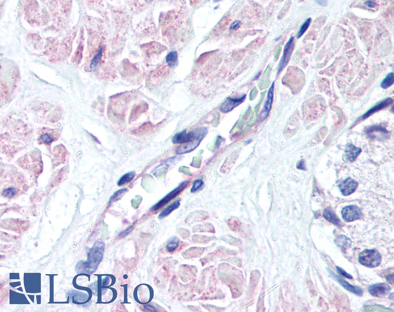 SIPR3 / EDG3 / S1P3 Antibody - Anti-EDG3 antibody IHC of human prostate, vessel. Immunohistochemistry of formalin-fixed, paraffin-embedded tissue after heat-induced antigen retrieval. Antibody concentration 10 ug/ml.