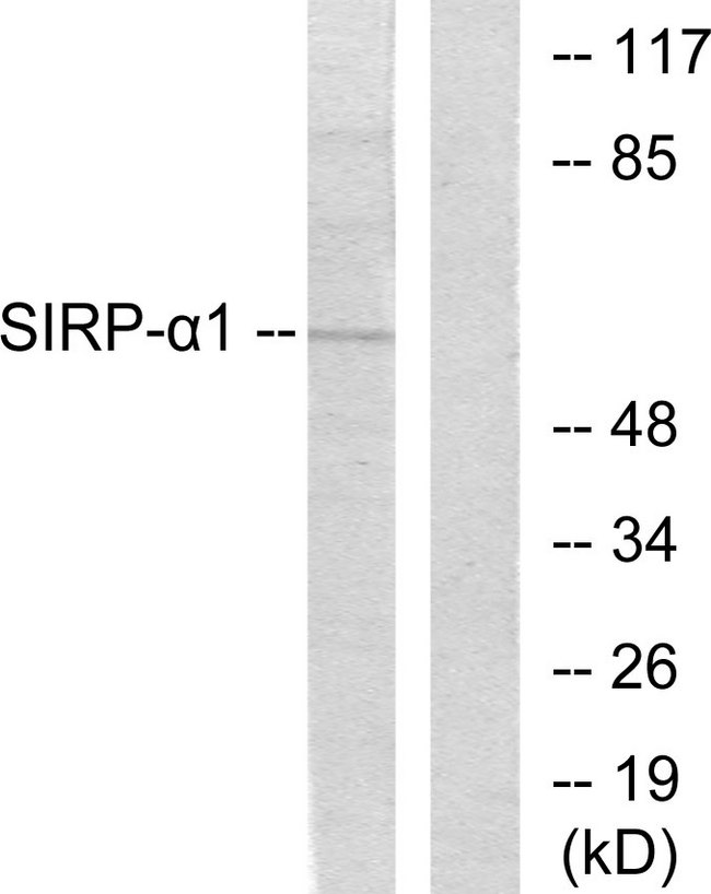 SIRPA / CD172a Antibody - Western blot analysis of lysates from HepG2 cells, using Sirp alpha1 Antibody. The lane on the right is blocked with the synthesized peptide.