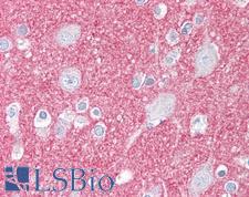 SIRPA / CD172a Antibody - Anti-SIRPA antibody IHC of human brain, cortex. Immunohistochemistry of formalin-fixed, paraffin-embedded tissue after heat-induced antigen retrieval. Antibody dilution 1:100.