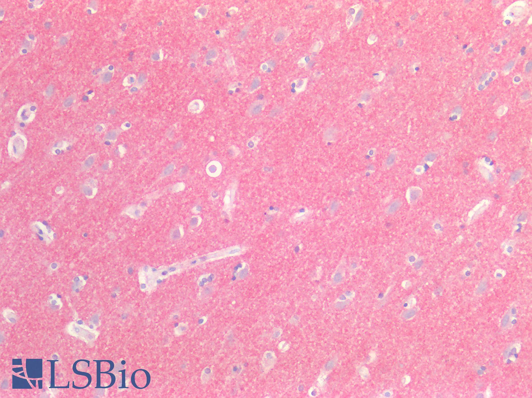 SIRPA / CD172a Antibody - Human Brain, Cortex: Formalin-Fixed, Paraffin-Embedded (FFPE)