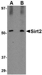 SIRT2 / Sirtuin 2 Antibody - Western blot of SIRT2 in Mouse brain lysate with SIRT2 antibody at (A) 1 and (B) 2 ug/ml.