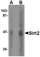 SIRT2 / Sirtuin 2 Antibody - Western blot of SIRT2 in human brain lysate with SIRT2 antibody at (A) 2.5 and (B) 5 ug/ml.
