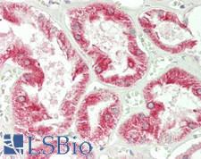 SIRT3 / Sirtuin 3 Antibody - Human Kidney: Formalin-Fixed, Paraffin-Embedded (FFPE)