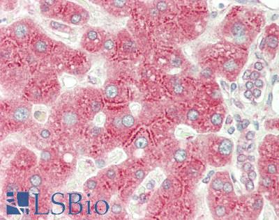 SIRT3 / Sirtuin 3 Antibody - Human Liver: Formalin-Fixed, Paraffin-Embedded (FFPE)