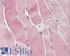 SIRT4 / Sirtuin 4 Antibody - Anti-SIRT4 antibody IHC of human skeletal muscle. Immunohistochemistry of formalin-fixed, paraffin-embedded tissue after heat-induced antigen retrieval. Antibody concentration 5 ug/ml.