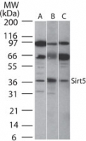 SIRT5 / Sirtuin 5 Antibody - Western blot of SIRT5 in A) human, B) mouse and C) rat intestine cell lysate using antibody at 2 ug/ml.