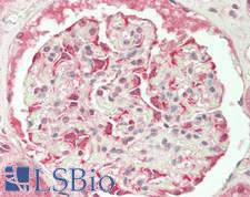 SIRT5 / Sirtuin 5 Antibody - Human Kidney: Formalin-Fixed, Paraffin-Embedded (FFPE)