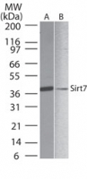 SIRT7 / Sirtuin 7 Antibody - Western blot of SIRT7 in A) human liver and B) PBMC lysate using antibody at 1 ug/ml.