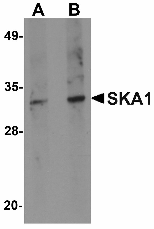 SKA1 Antibody - Western blot of SKA1 in A549 cell lysate with SKA1 antibody at (A) 0.5 and (B) 1 ug/ml.