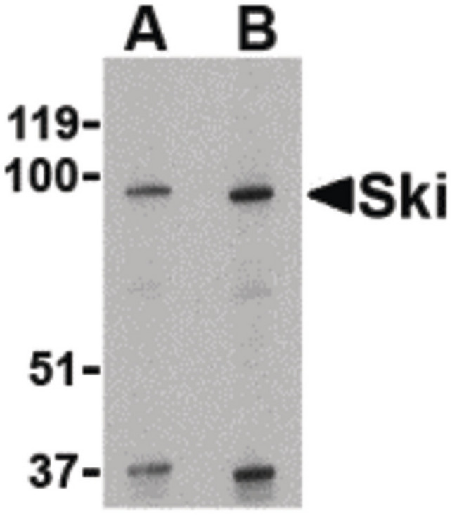SKI Antibody - Western blot of Ski in human kidney tissue lysate with Ski antibody at (A) 1 and (B) 2 ug/ml.