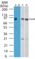 SKIL / SNO / SnoN Antibody - Western blot of SnoN in human kidney cell lysate in the A) absence and B) presence of immunizing peptide, C) mouse kidney, and D) rat kidney cell lysate, using antibody at 1 ug/ml.